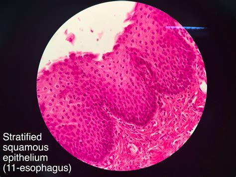 Stratified Squamous Epithelium Non Keratinized