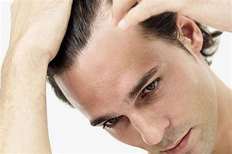 The management of hair loss, also known as alopecia or baldness, may include medications and surgery. Best Hair Loss Treatment For Men | Online Health Wiki