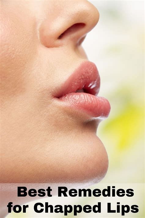 8 Best Remedies For Chapped Lips Beauty Crafter