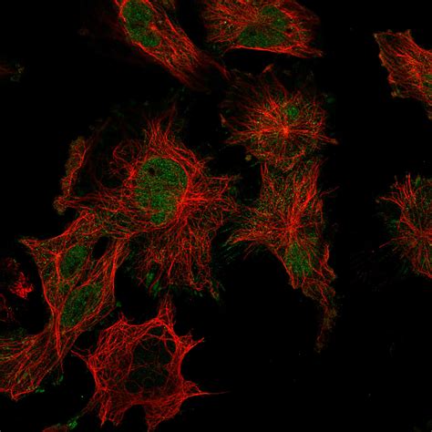 În acest articol vom vorbi despre proteine, unul din elementele cruciale pentru o alimentare sănătoasă. Cell atlas - SENP1 - The Human Protein Atlas
