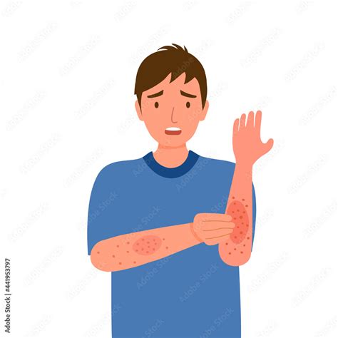 Young Man Scratching Arm Guy Suffering From Strong Allergy Skin Itchy