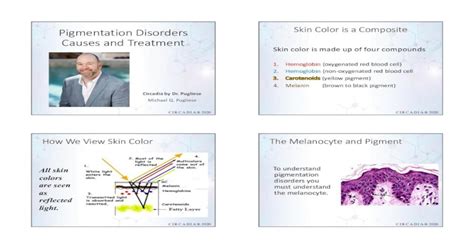 Pigmentation Disorders Skin Color Is A Composite Causes