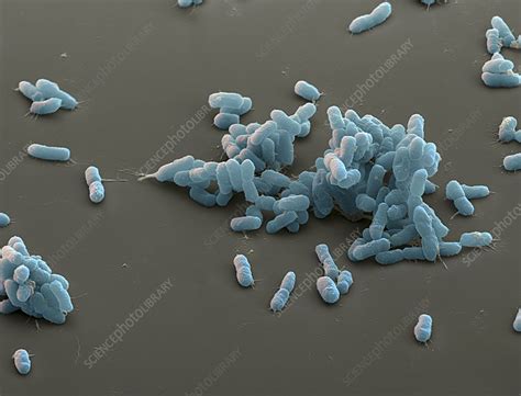 The epidemiological use of the term plague is currently applied to bacterial infections that cause buboes, although historically the medical use of the term plague. Plague bacteria, Yersinia pestis, SEM - Stock Image - C009 ...