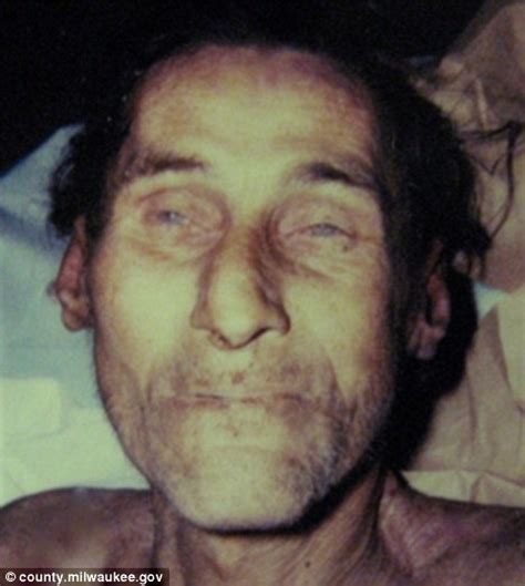 The Unclaimed Dead Medical Examiners Post Photos Of Unidentified