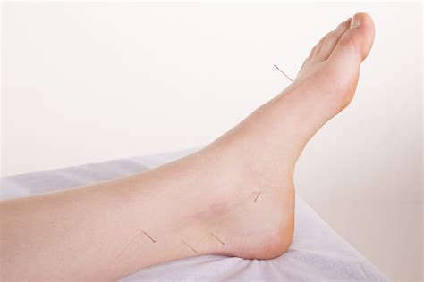 Plantar fasciitis is the most common cause of heel pain. Acupuncture For Plantar Fasciitis: Foot & Heel Pain Relief ...