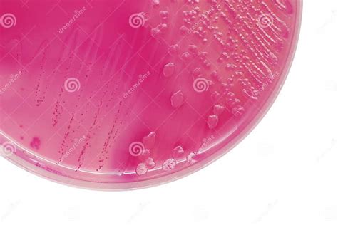 Li Bacterial Colonies On Macconkey Agar Plate Stock Photo Image
