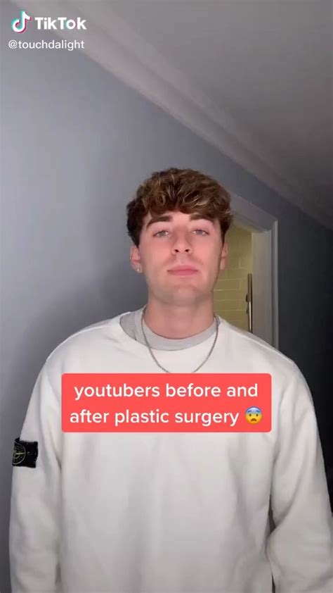 Did Not Know Jj Got Plastic Surgery Sidemen