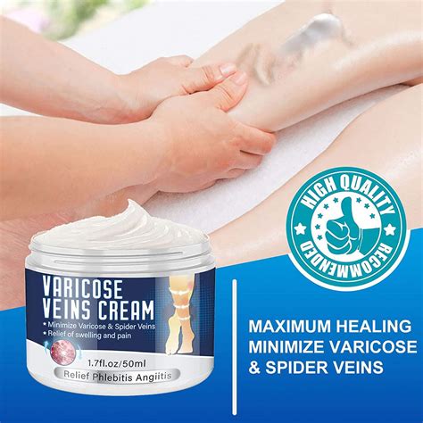 Varicose Veins Cream Veins Treatment Cream For Legs Natural Extract