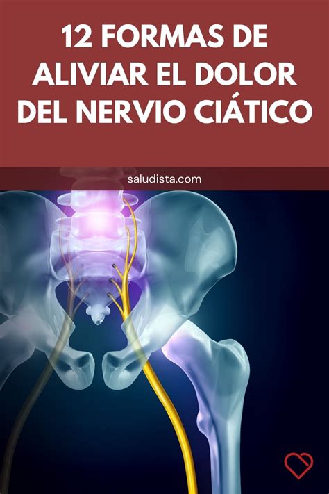 Formas de aliviar el dolor del nervio ciático