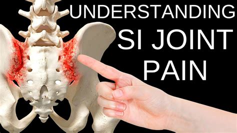 How To Properly Wear A Sacroiliac Si Belt For Quick Si Joint Pain