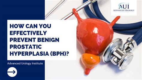 How Can You Effectively Prevent Benign Prostatic Hyperplasia BPH Advanced Urology Institute