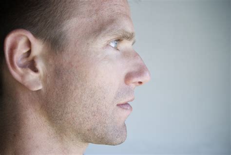 What Causes A Nasal Dorsal Hump — Dr Geoffrey Tobias New Jersey