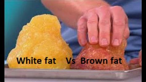 Brown Fat Benefits Against Obesity Surprising Facts