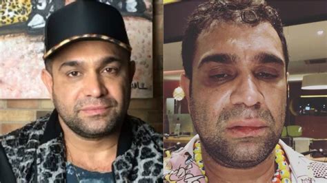 Atualmente, evandro santo (@evandrosanto) tem 660476 seguidores no instagram, está em 750. Evandro Santo posta foto machucado e desabafa sobre ...