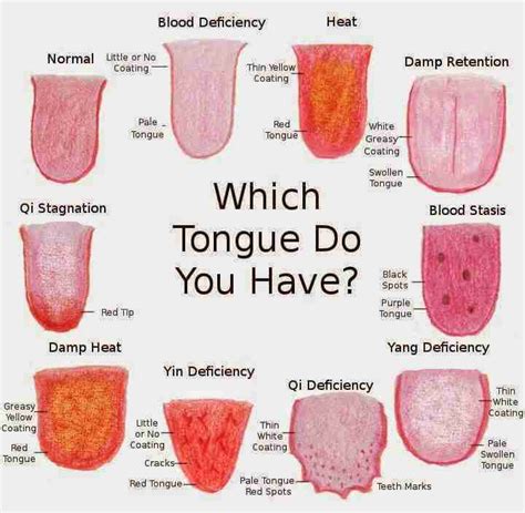 What The Color Of Your Tongue Says About Your Health
