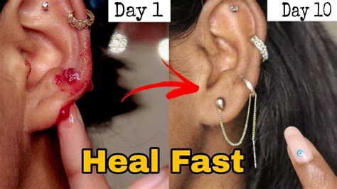 How To Heal Infected Earnose Piercing Fast Pus Bump Bleeding Swelling Aftercare Youtube