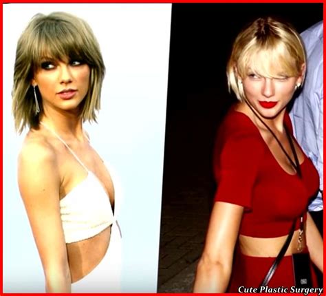 Taylor Swift Plastic Surgery Celebrities Plastic Surgery