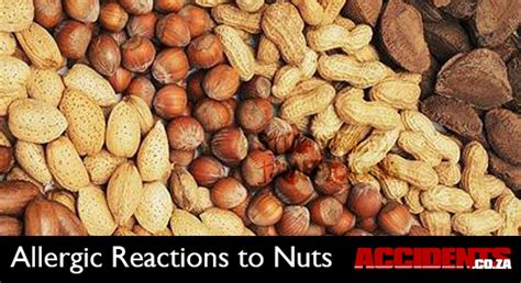 Er24 Shares Information On Allergic Reactions To Nuts Za