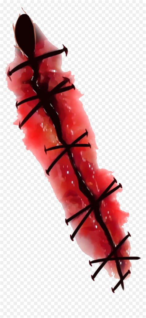 The research team examined resident bacteria in the body, their effect on the production of white blood cells, and the role. #hurt #stiches #sticker #blood #bleeding #cut #creepy ...
