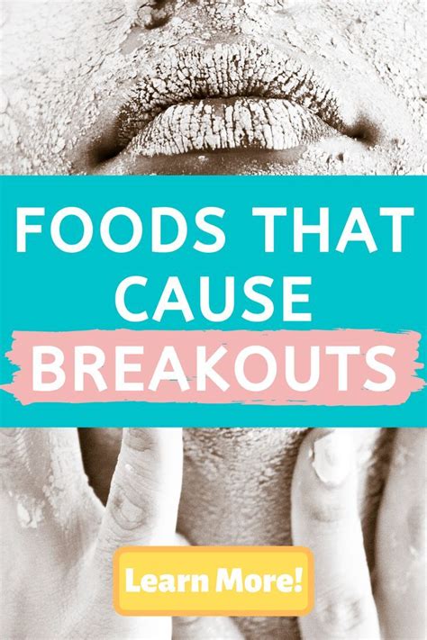 Foods That Cause Breakouts Bad Acne Skin Care Acne Best Masks For Acne