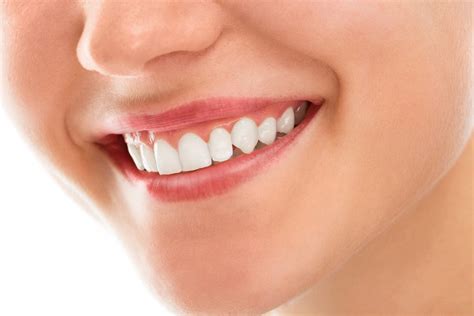 4 Ways A Cosmetic Dentist Can Transform Your Smile Dental On Clarendon
