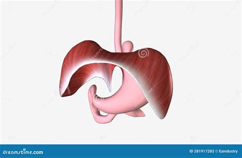 A Hiatal Hernia Is A Condition In Which The Upper Part Of The Stomach
