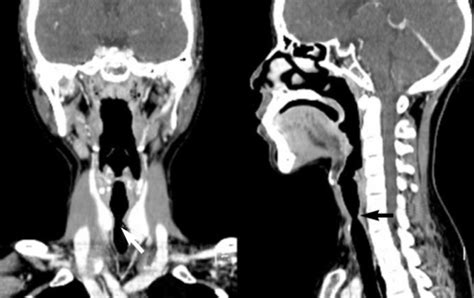 If you are considering to buy a ct scanner you have come to the right place. Figure 1:Successful Treatment of Tracheal Stenosis with ...
