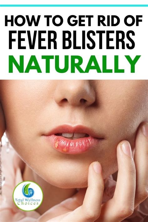 13 Natural Home Remedies For Fever Blisters On The Lips Home Remedies