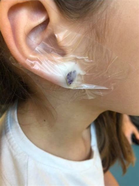 Claires Accessories Ear Piercing Left Girl 7 In Hospital Metro News