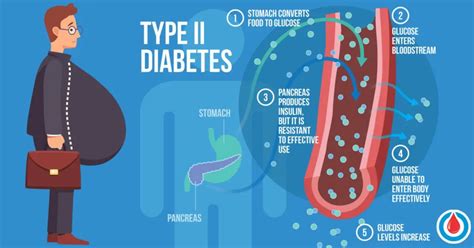 the link between diabetes and obesity diabetes health page