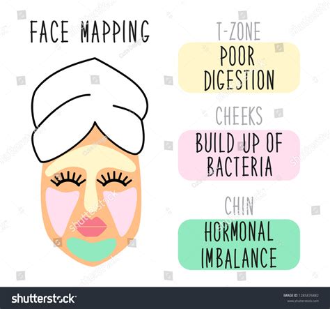 Cute Infographic Face Mapping Reasons Acne Stock Vector Royalty Free 1285876882