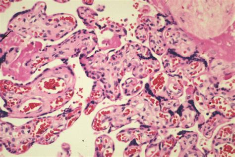 Placenta Histology