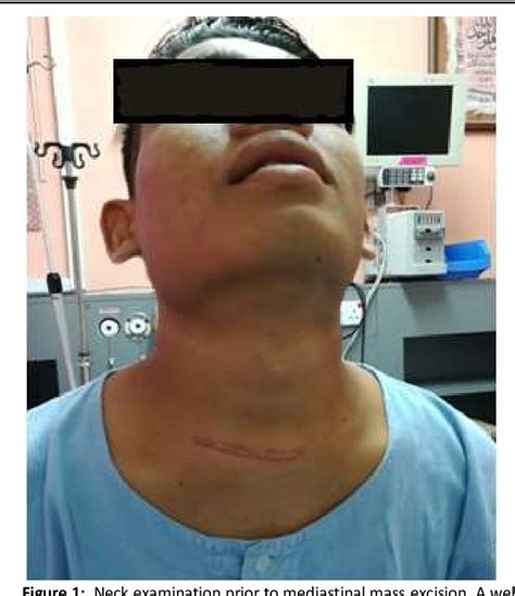 Figure 1 From Anterior Neck Swelling In A Healthy Young Man As The Tip