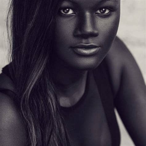 Teen Khoudia Diop Who Was Bullied Because Of Her Dark Skin Becomes A