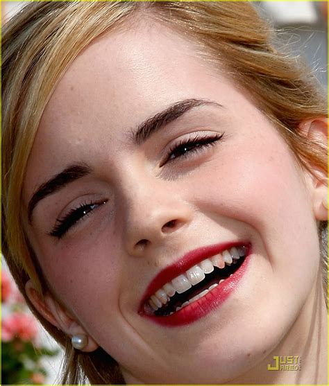 Emma Watson Has Lipstick Teeth Photo 1299631 Emma Watson Pictures