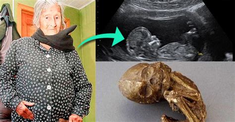Photos Meet Year Old Woman Who Carried A Baby In Her Womb For More