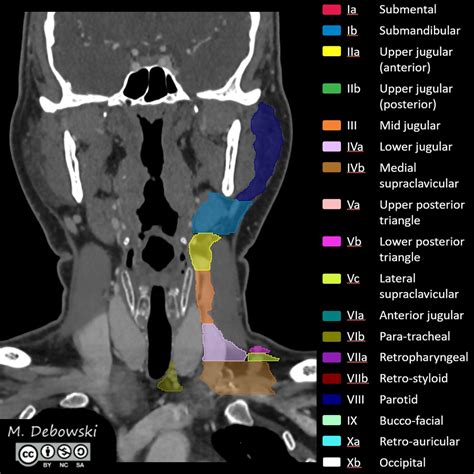 Lymph Node Levels Of The Head And Neck Annotated Ct Image
