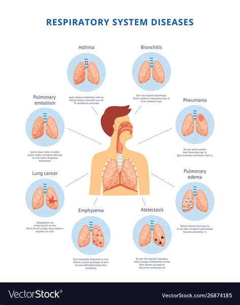 Human Respiratory System Diseases Informative Vector Image