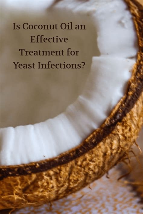 Is Coconut Oil An Effective Treatment For Yeast Infections