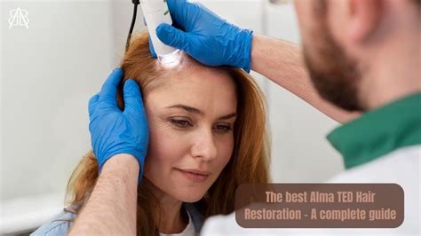 The Best Alma Ted Hair Restoration A Complete Guide