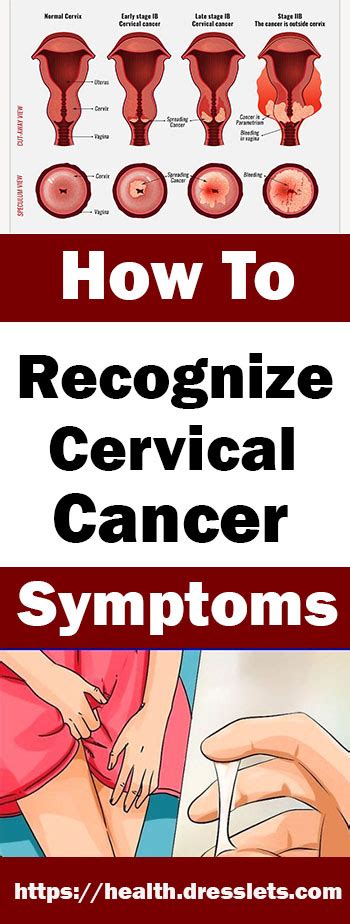 Find out more information and get support. How to Recognize Cervical Cancer Symptoms - Ultimate guide ...