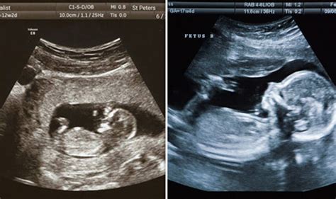 Where can i get a fake ultrasound picture? 70p fake pregnancy app feared as perfect tool for lying ...