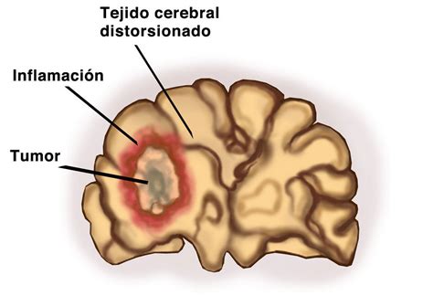 O Que é Parênquima Cerebral
