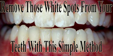 Try colgate optic white renewal today. Pin on Natural Remedies