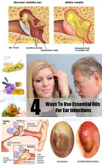 ear infection treatment with essential oils philadelphia holistic clinic
