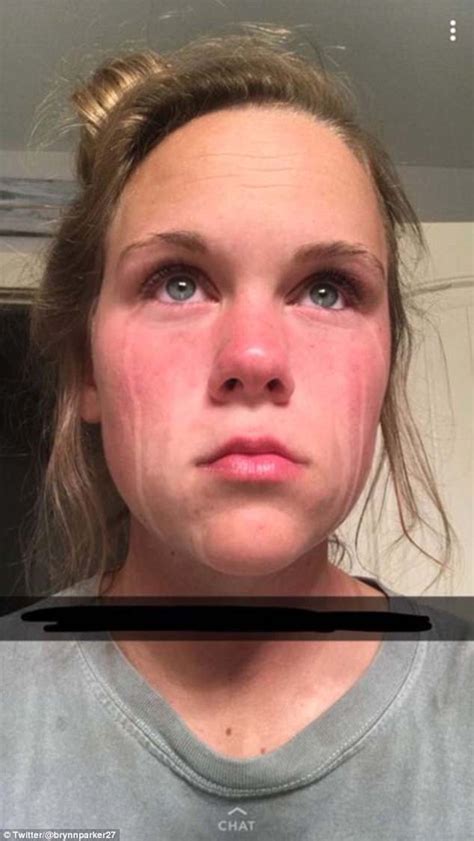 Woman Is Left With Streaks Because She Cried After Applying Fake Tan