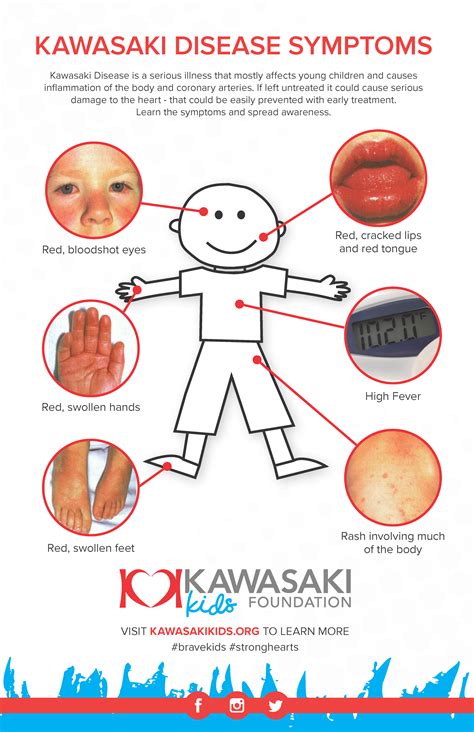 Order Kawasaki Disease Posters Kawasaki Kids Foundation