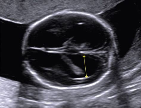 Fetal Imaging Obgyn Key