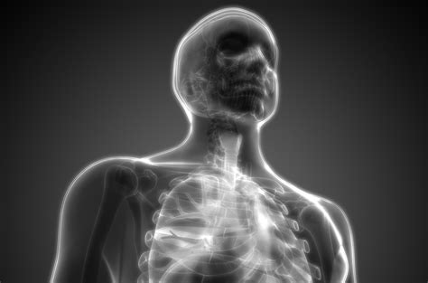 Based on the findings, you may undergo further testing to determine whether mesothelioma or another disease is causing your symptoms. Mesothelioma sufferer's treatment to be covered by a ...