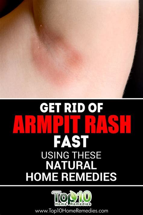 How To Heal Armpit Rashes Food Blog